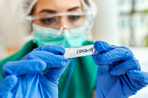 Latest company news about COVID: стоит ли опасаться новой зимней волны инфекций?